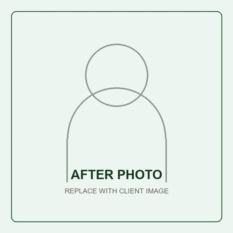 Placeholder for an after microneedling treatment photo