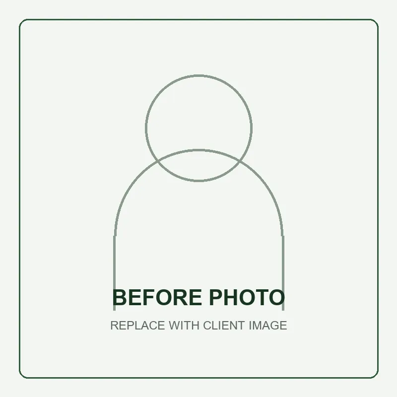 Placeholder for a before skin texture treatment photo